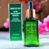 BREYLEE Acne Treatment Serum 17ml