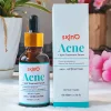 SkinO Acne + Spot Treatment Serum 30ml